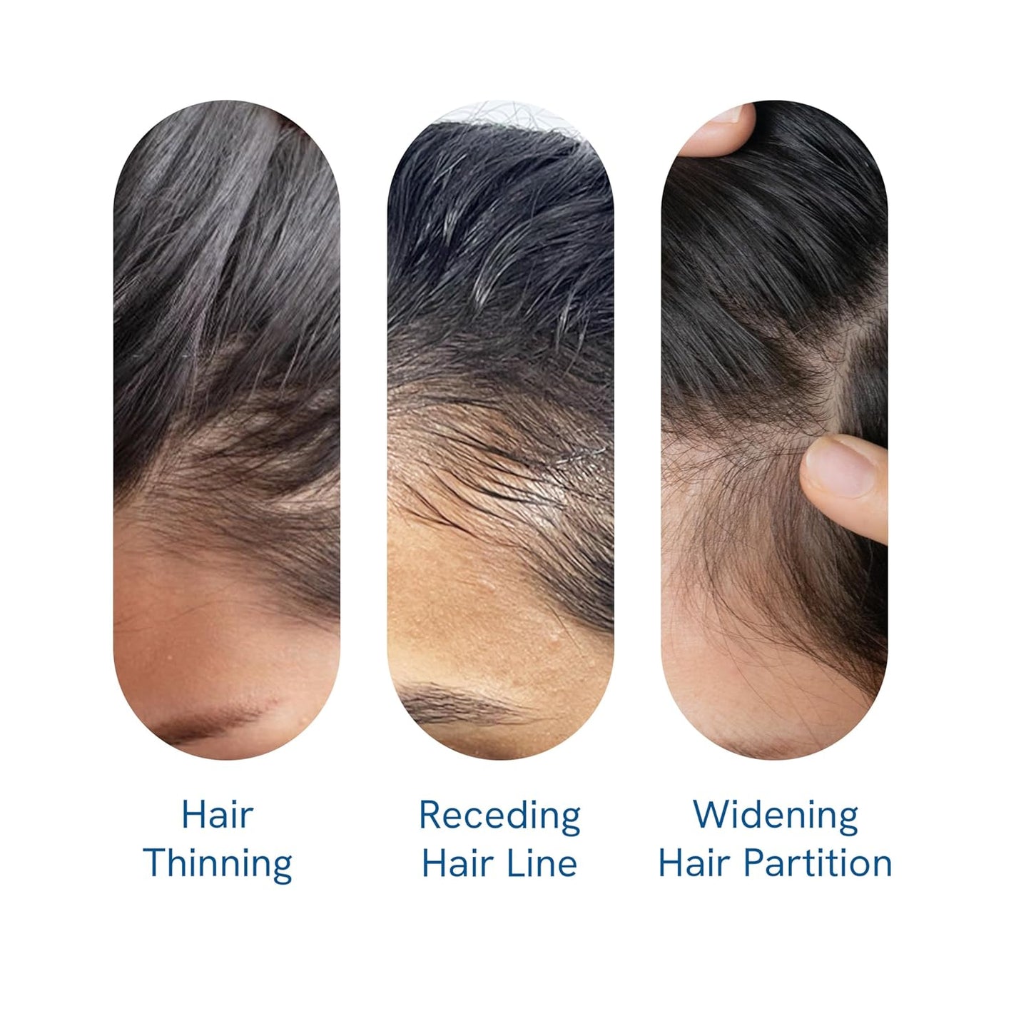 Advanced Hair Growth Roll-On Serum