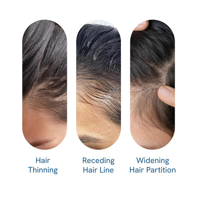 Advanced Hair Growth Roll-On Serum